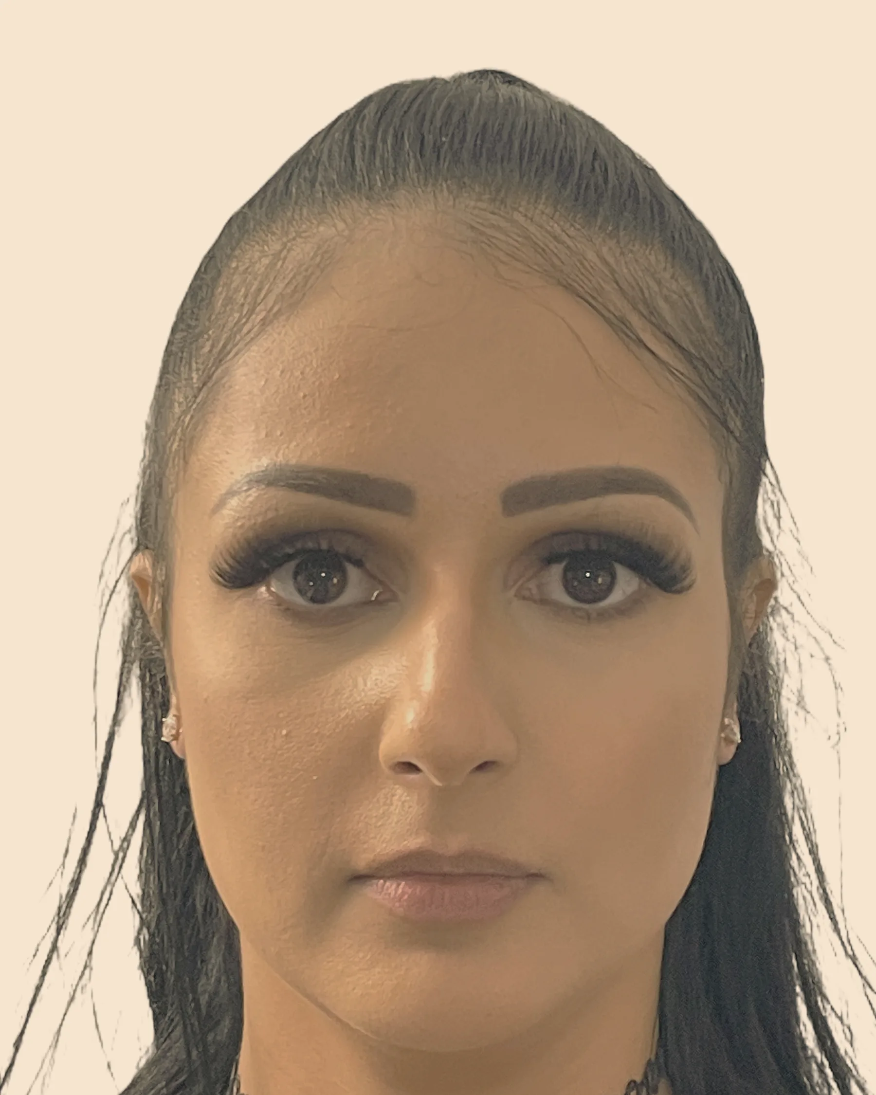 Antes: rosto de frente de uma mulher de cabelo escuro preso, com os lábios finos, sobre fundo claro
