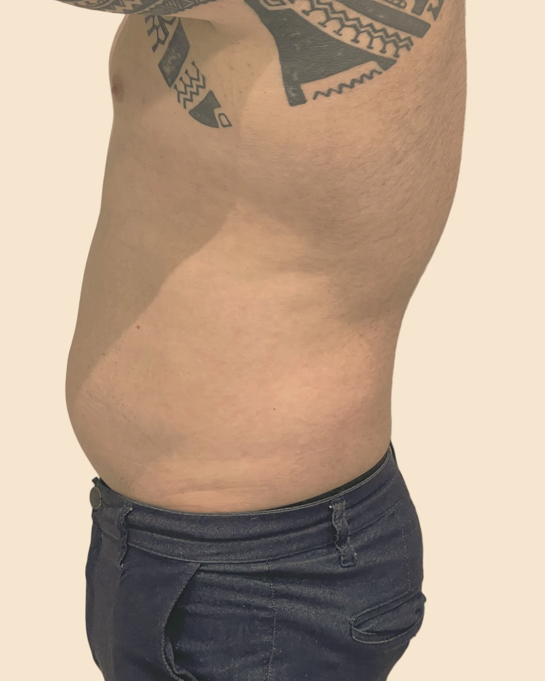 Antes: abdômen de perfil de um homem, com a barriga projetada para a frente, sobre fundo claro