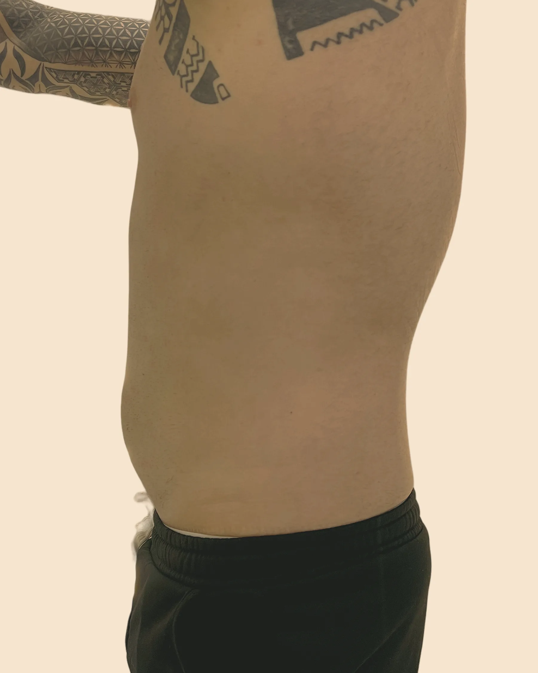Depois: o mesmo abdômen de perfil, mais plano e com a barriga menos projetada, sobre fundo claro