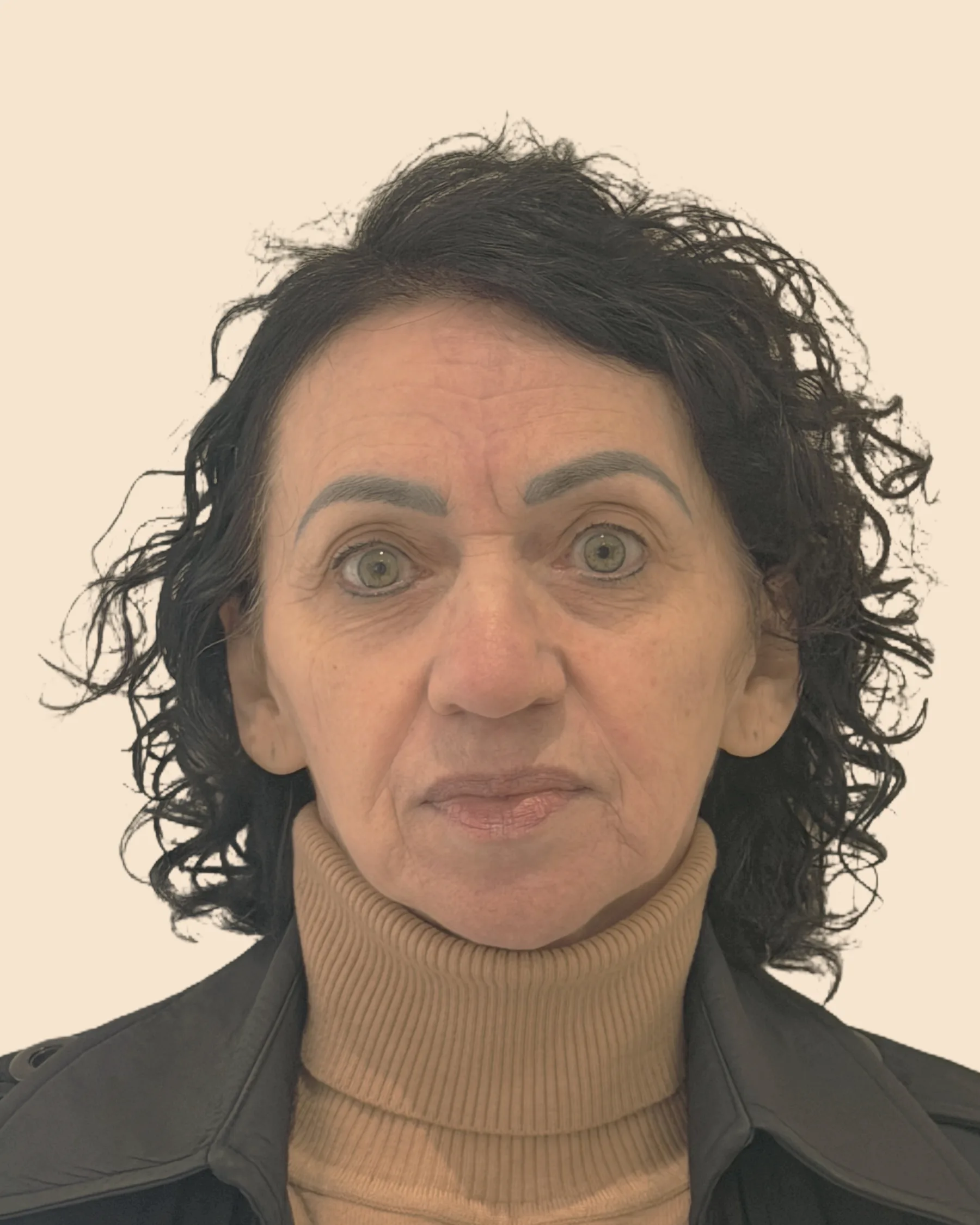 Antes: rosto de frente de uma mulher de cabelo escuro e cacheado, com a pele do rosto e do pescoço mais flácida, sobre fundo claro