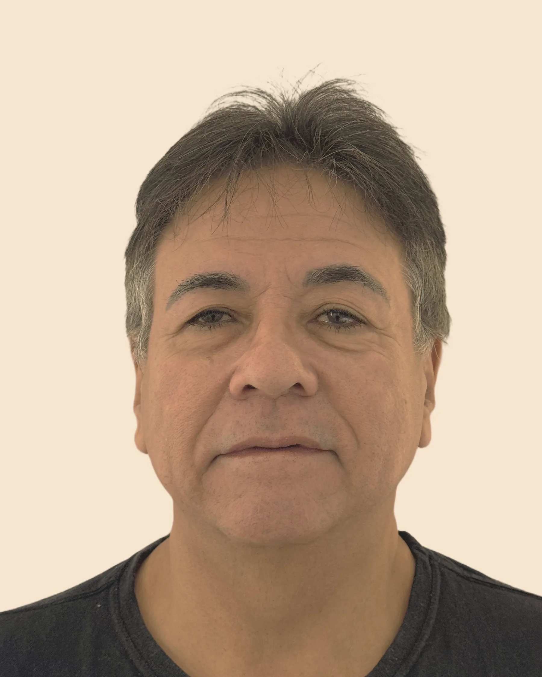 Antes: rosto de frente de um homem de cabelo grisalho, com rugas e sulcos mais marcados, sobre fundo claro
