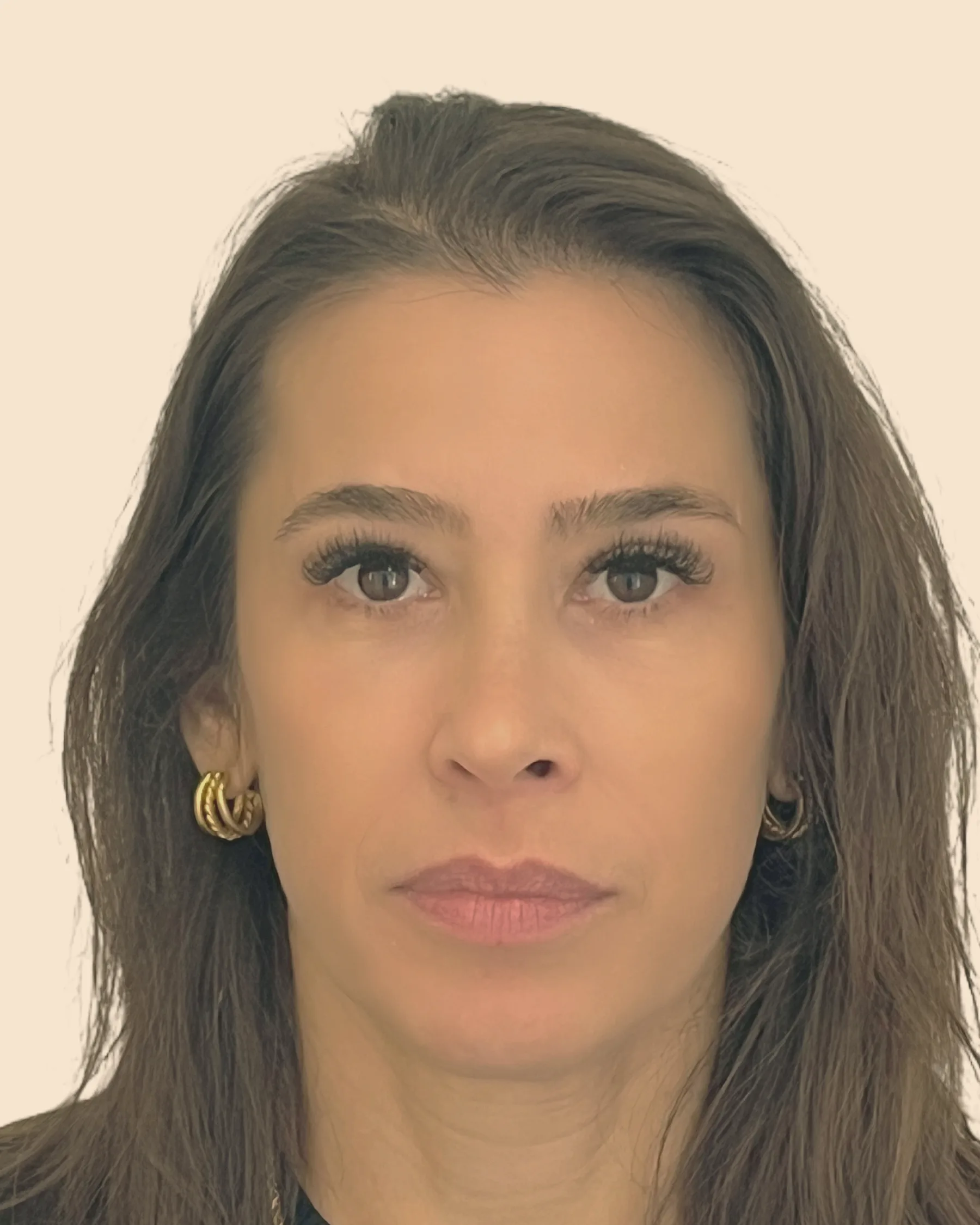 Depois: o mesmo rosto de frente, com o rosto mais preenchido e as olheiras mais suaves, sobre fundo claro
