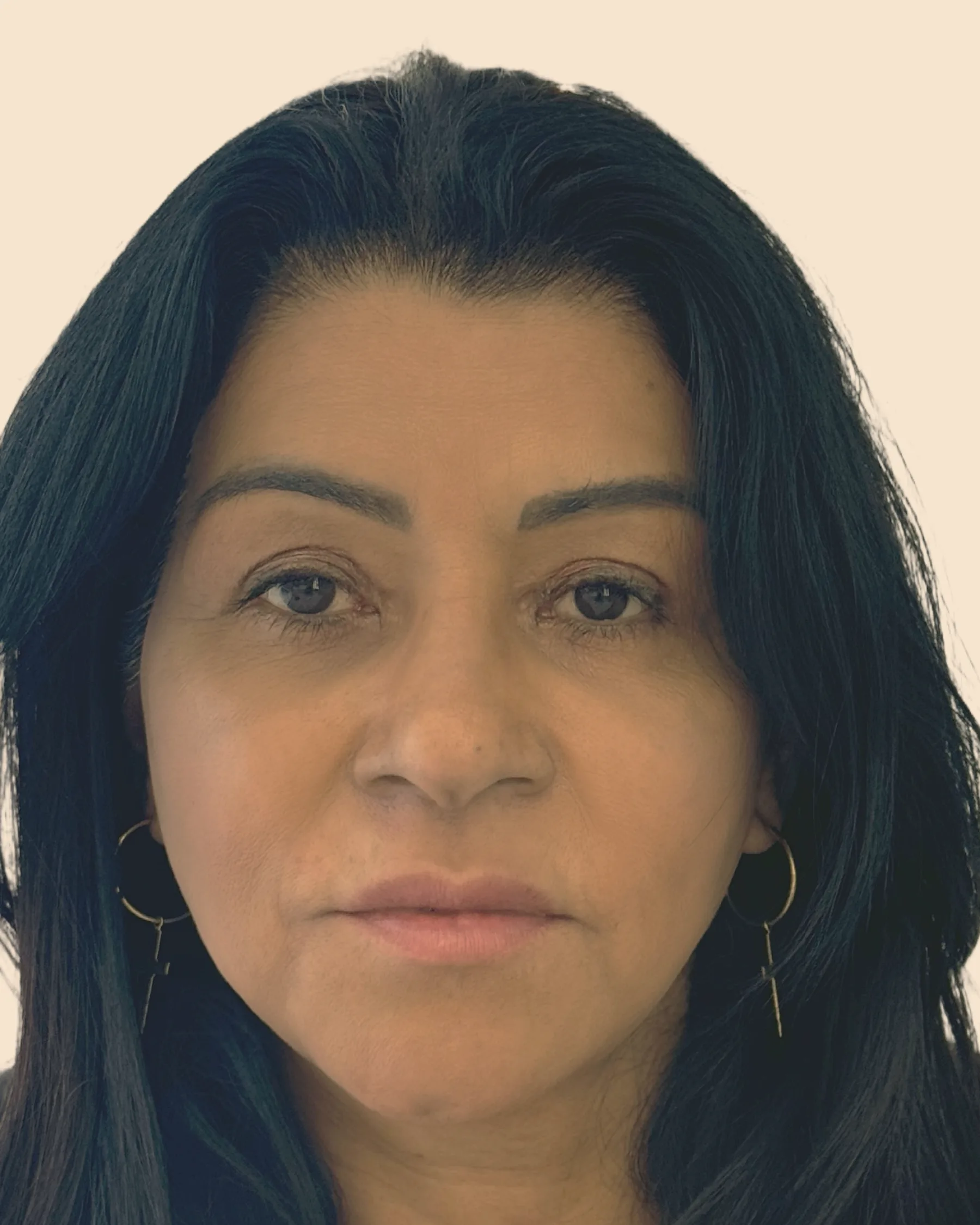Depois: o mesmo rosto de frente, com a região dos olhos mais descansada e o contorno do rosto mais firme, sobre fundo claro
