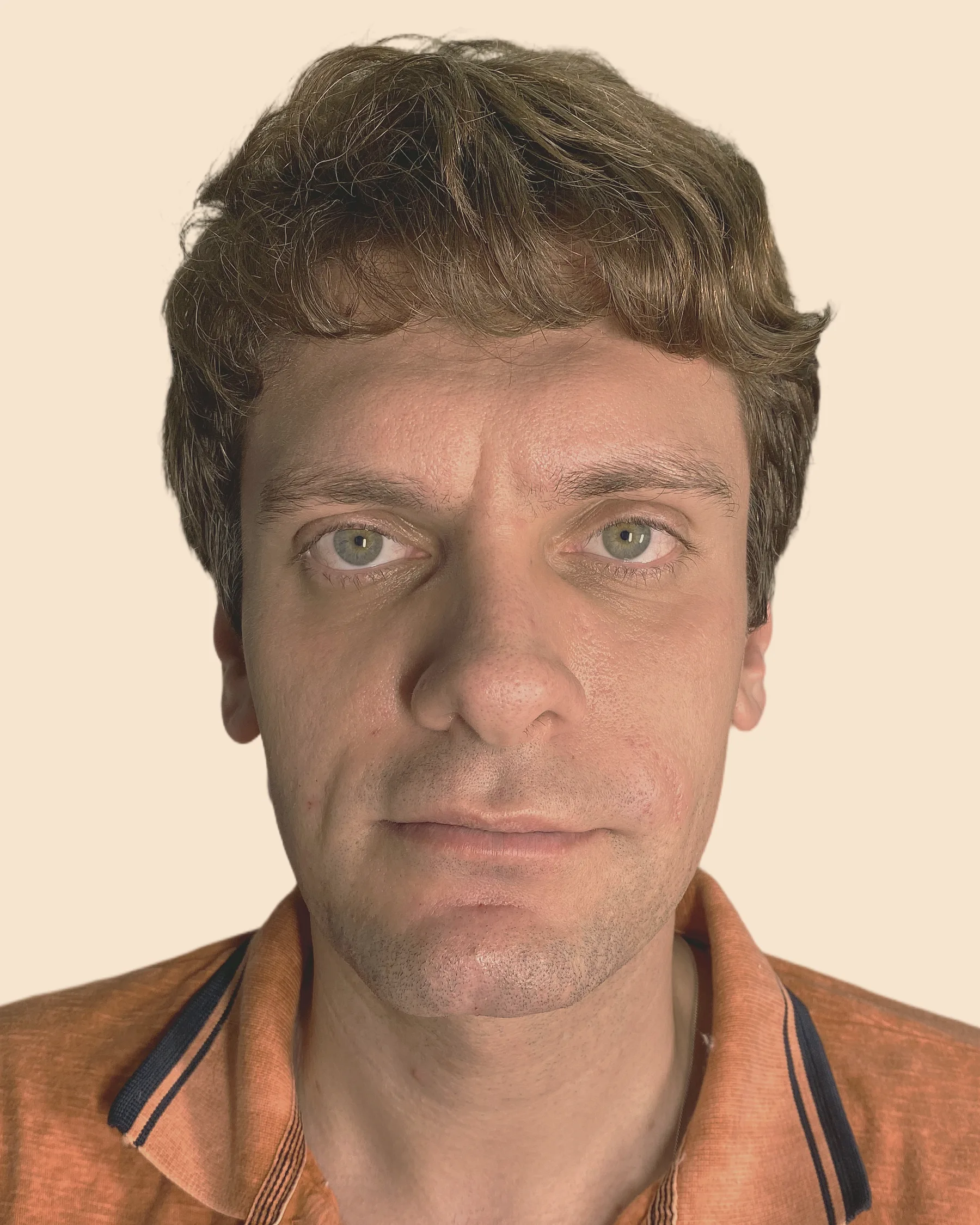 Antes: rosto de frente de um homem de cabelo castanho e ondulado, com olheiras e sulcos marcados, sobre fundo claro